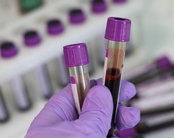 Enterprise Alabama phlebotomy technician with blood samples