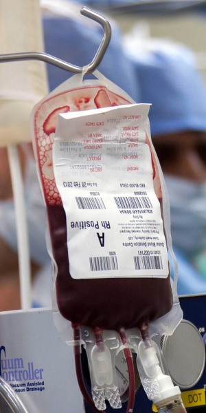 blood IV fluid drip bag in Birmingham Alabama hospital