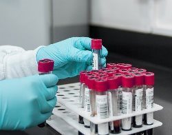 Opelika Alabama phlebotomist placing test tube samples in rack