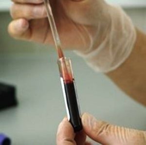 phlebotomist testing blood sample